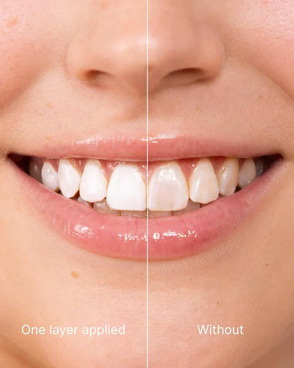 Orahue™ Teeth Polish - Instant White Teeth