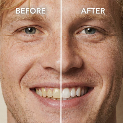 Orahue™ Teeth Polish - Instant White Teeth